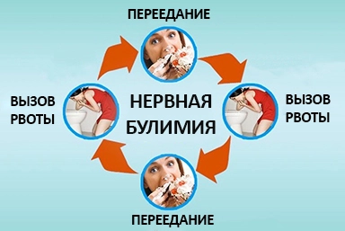 Лечение булимии в Новокуйбышевске